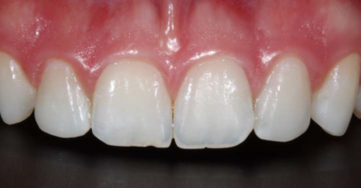 Solventum – Ästhetische Zahnrestauration mit Dr. Cura